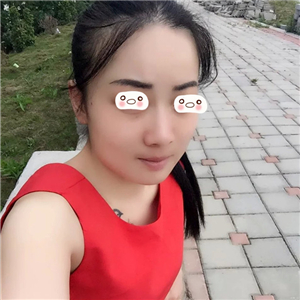 愛(ài)斯克做了高強(qiáng)度聚焦超聲5個(gè)月了，看看我的果照片，不錯(cuò)哦~~