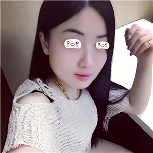 愛(ài)斯克做了高強(qiáng)度聚焦超聲5個(gè)月了，看看我的果照片，不錯(cuò)哦~~