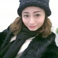 玻尿酸墊下巴后改變了我的大餅?zāi)樄镣淄椎? /> </a>
										<a href=