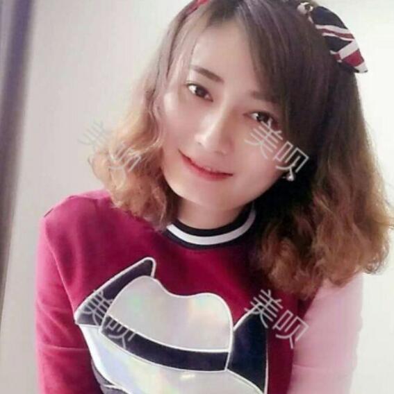 玻尿酸墊下巴后改變了我的大餅?zāi)樄镣淄椎? /> </a>
									</div>
								</dd>
							</dl><dl>
								<dt>
							<a href=