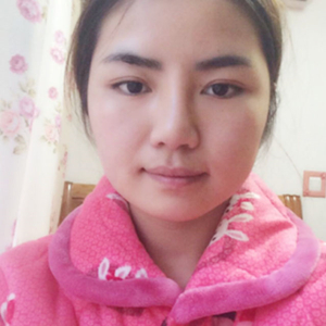 磨骨磨下頜角半年了，分享恢復(fù)過(guò)程和前后對(duì)比果照片哦~