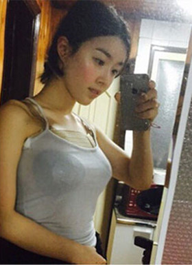 假體隆胸手術(shù)恢復過程分享，還有前后對比照片哦