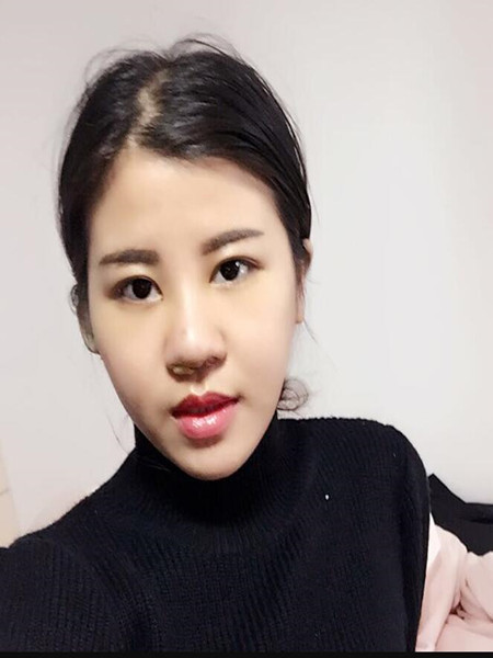 終于做里隆鼻整形手術(shù) 快來(lái)圍觀我時(shí)候果吧