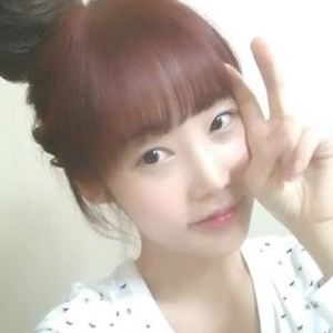 做地包天矯正手術(shù)五個(gè)月了，恢復(fù)得不錯(cuò)，有前后對比果圖片哦~