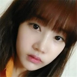 做地包天矯正手術(shù)五個(gè)月了，恢復(fù)得不錯(cuò)，有前后對比果圖片哦~