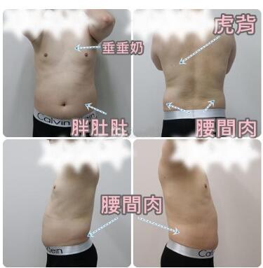 肥胖照片