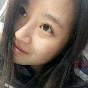 做了玻尿酸隆眉弓，感覺棒棒噠