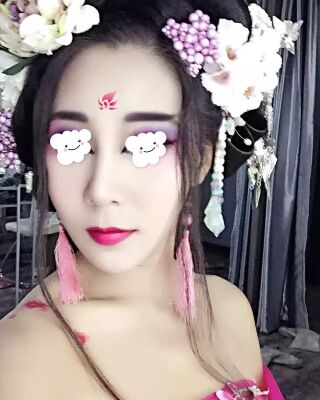 隆鼻失敗修復(fù)后整給鼻形很精致，鄭志敏醫(yī)生做的