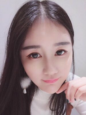 硅膠隆鼻+耳軟骨墊鼻尖后美到朋友認不出