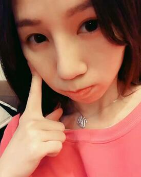 隆鼻整形術(shù)后1-7天的照片 隆鼻整形經(jīng)歷分享