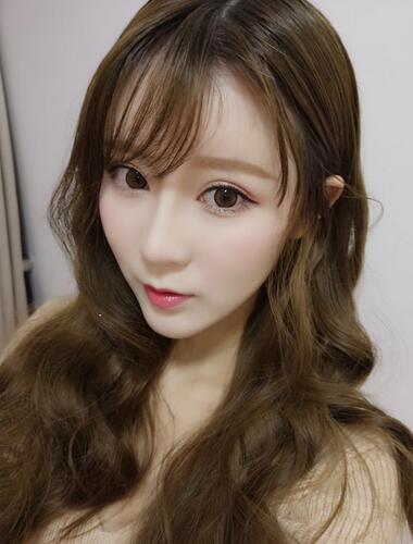 鄭州悅美微創(chuàng)雙眼皮+開眼角3個(gè)月