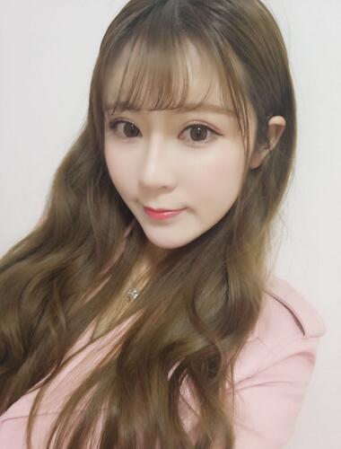 鄭州悅美微創(chuàng)雙眼皮+開眼角3個(gè)月