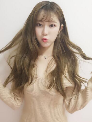 鄭州悅美微創(chuàng)雙眼皮+開眼角3個(gè)月