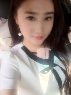 膨體隆鼻改變了我的塌鼻子，整體都精致不少