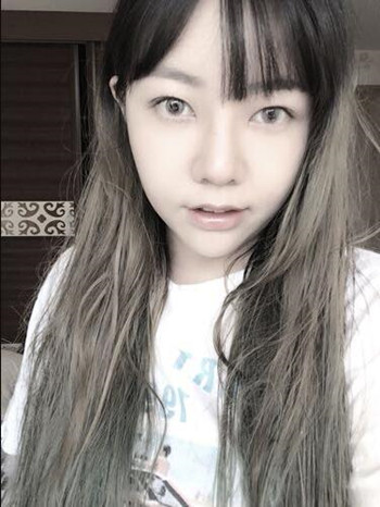 做了隆鼻整形手術果真的很不錯 大家快來看看吧