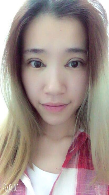 做了全切雙眼皮 整個眼睛都變大了氣質也不一樣了