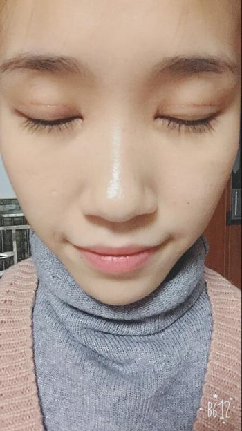 做了全切雙眼皮 整個眼睛都變大了氣質也不一樣了
