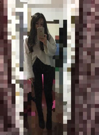 做了大腿吸脂手術 我的腿從大象腿變成螞蟻腿