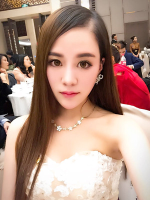 埋線面b提拉一個月之后還是美美噠