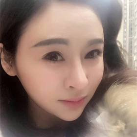 自體脂肪填充面部前后過程以及對比照片，真實案例分享