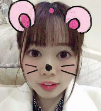 深圳晨曦三點定位雙眼皮日記