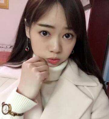 深圳晨曦三點定位雙眼皮日記