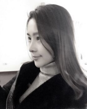 隆鼻整形改變了我整體鼻子的形狀