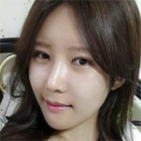 做了埋線雙眼皮、隆鼻、磨下頜角，兩個(gè)月了，分享恢復(fù)照片~