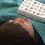 美容冠牙齒修復(fù)，緩解前后過程分享
