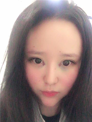 開了眼角之后，眼睛變得很勾人
