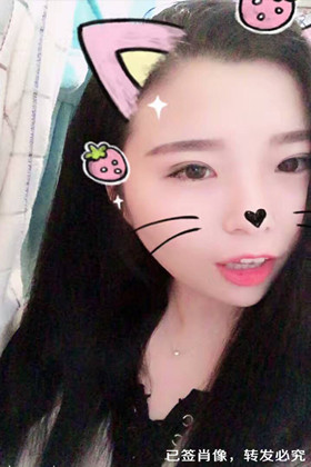 剛做了雙眼皮切開重瞼手術(shù)，恢復(fù)得越來越自然了