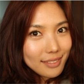 武漢希思特做了埋線法雙眼皮、開內(nèi)眼角和鼻尖移植軟骨整形手術(shù)~