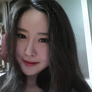 自體軟骨墊鼻尖手術(shù)前后對比果照片分享，看我的恢復過程~