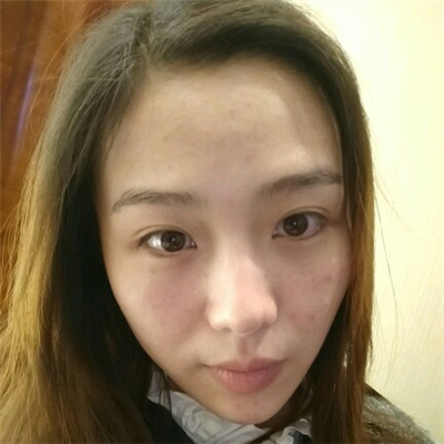 光子嫩膚和下巴脂肪填充術(shù)后果圖片分享，董萍門診做的~