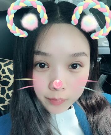 全切雙眼皮1個(gè)月過程圖