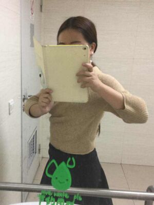 腰腹吸脂減肥果很好，恢復(fù)圖分享
