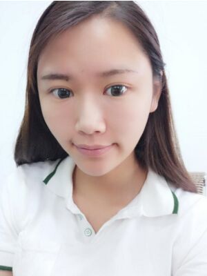 自體脂肪面部填充后恢復，成活率還蠻高的