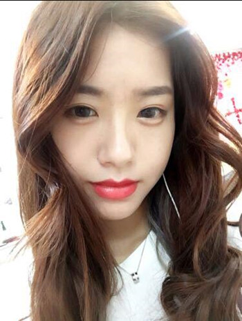 玻尿酸豐下巴果還不錯(cuò) 過(guò)幾個(gè)月就做假體隆下巴