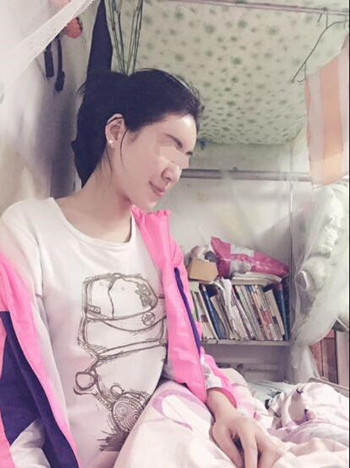 給大家分享一下我的自體脂肪填充全臉經(jīng)歷 內(nèi)有果對(duì)比圖