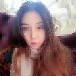 吸脂瘦臉手術半年了，分享前后對比果照片~
