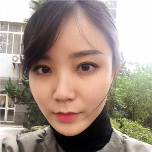 北京美萊做了雙眼皮手術(shù)，分享前后對比果圖片~