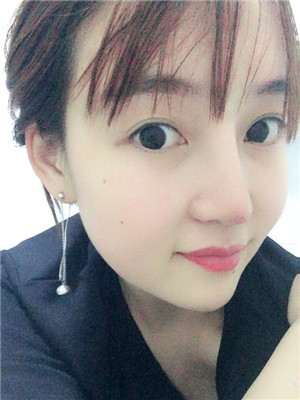 做完綜合鼻修復(fù)之后鼻子更加自然了