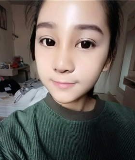 隆鼻整形日記，像變了個人似的