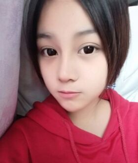 隆鼻整形日記，像變了個人似的