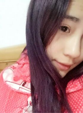 切開雙眼皮恢復過程 真實經(jīng)歷分享一下