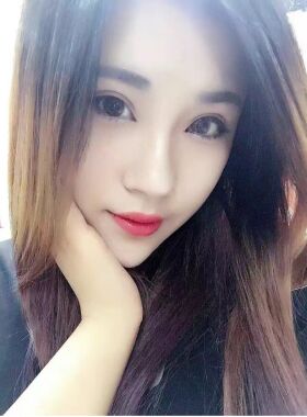 切開雙眼皮恢復過程 真實經(jīng)歷分享一下