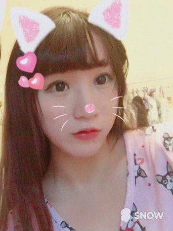 我做了玻尿酸豐唇和玻尿酸豐下巴 果還不錯(cuò)哦