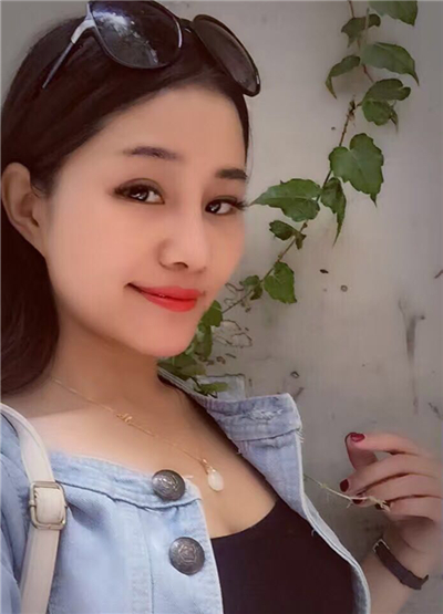 我做自體脂肪隆鼻手術(shù)恢復(fù)過(guò)程和前后對(duì)比果圖片分享哦~