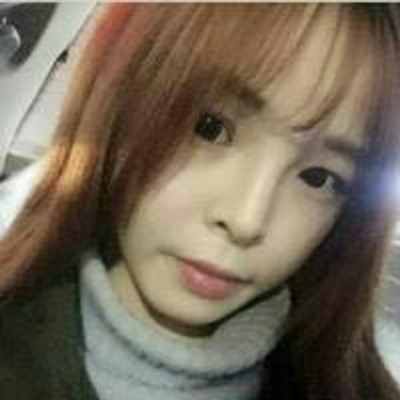 玻尿酸注射隆鼻三個月了，分享術(shù)后恢復(fù)照片哇~