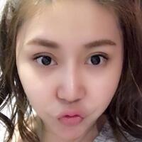 做鼻部綜合整形真是一件正確的決定，鼻子恢復(fù)過程分享